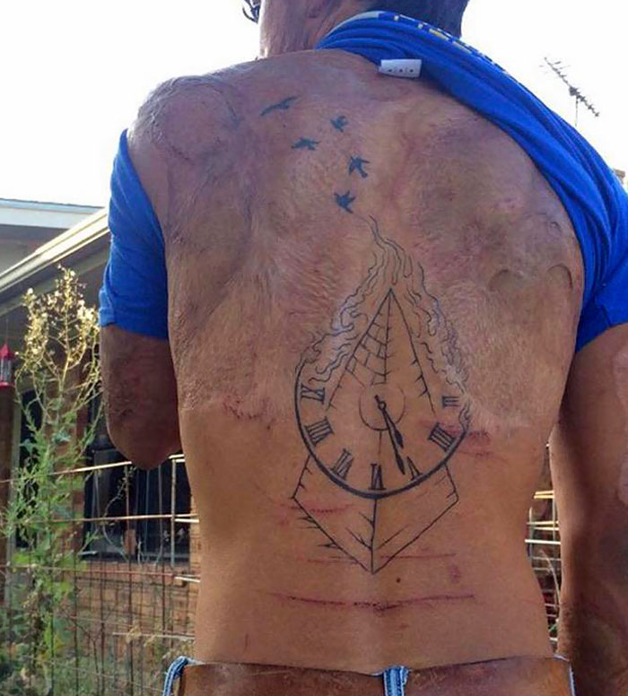 For All The People Who Have Never Seen Fully Healed Burn Scars, These Are What They Look Like (Excuse The Scratches)
