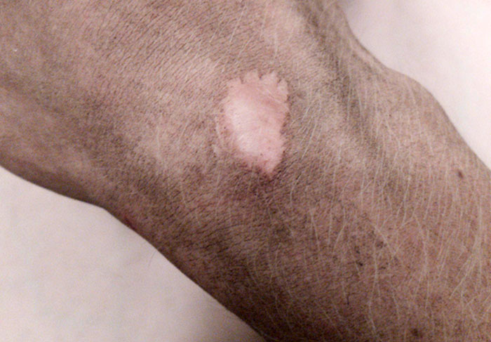 The Scar On My Hand Stays Clean, No Matter How Dirty My Hands Are