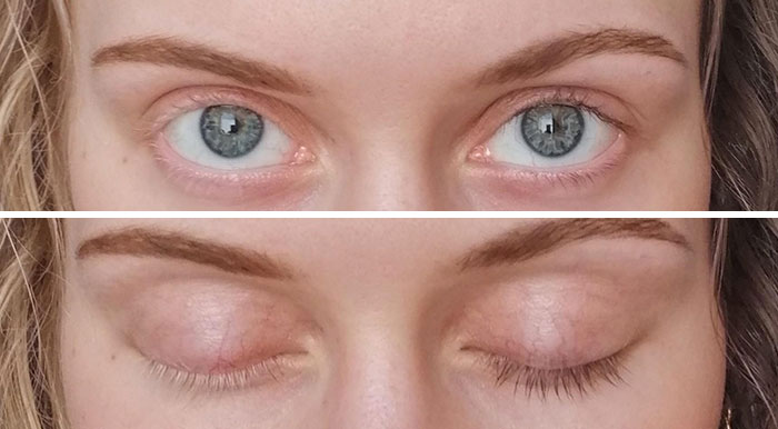 My Hair And Eyelashes Are Naturally Split Into Blonde And Brunette