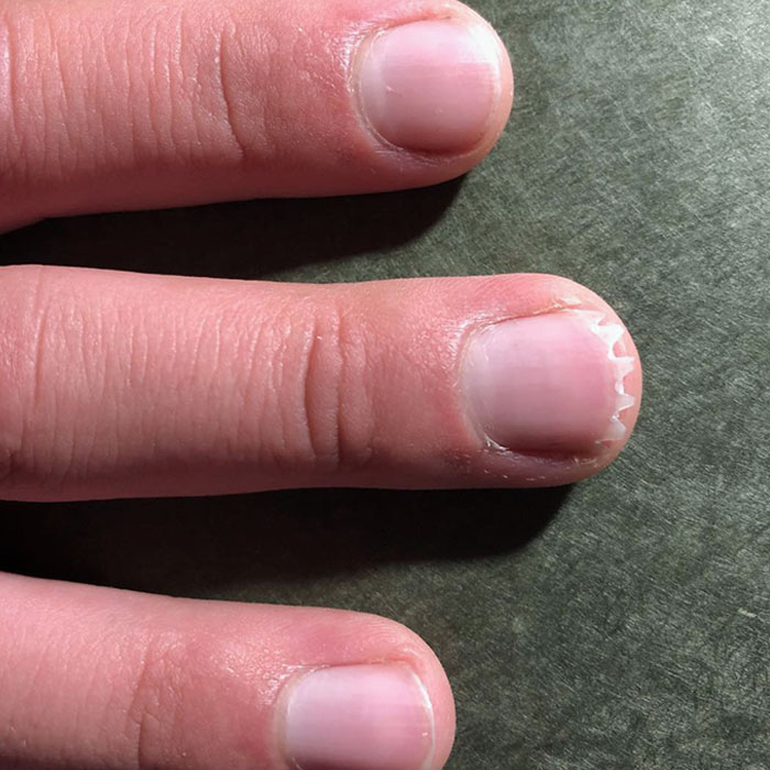 Younger Son Was Trimming His Fingernails Today And Decided To Give One Of Them A Crown