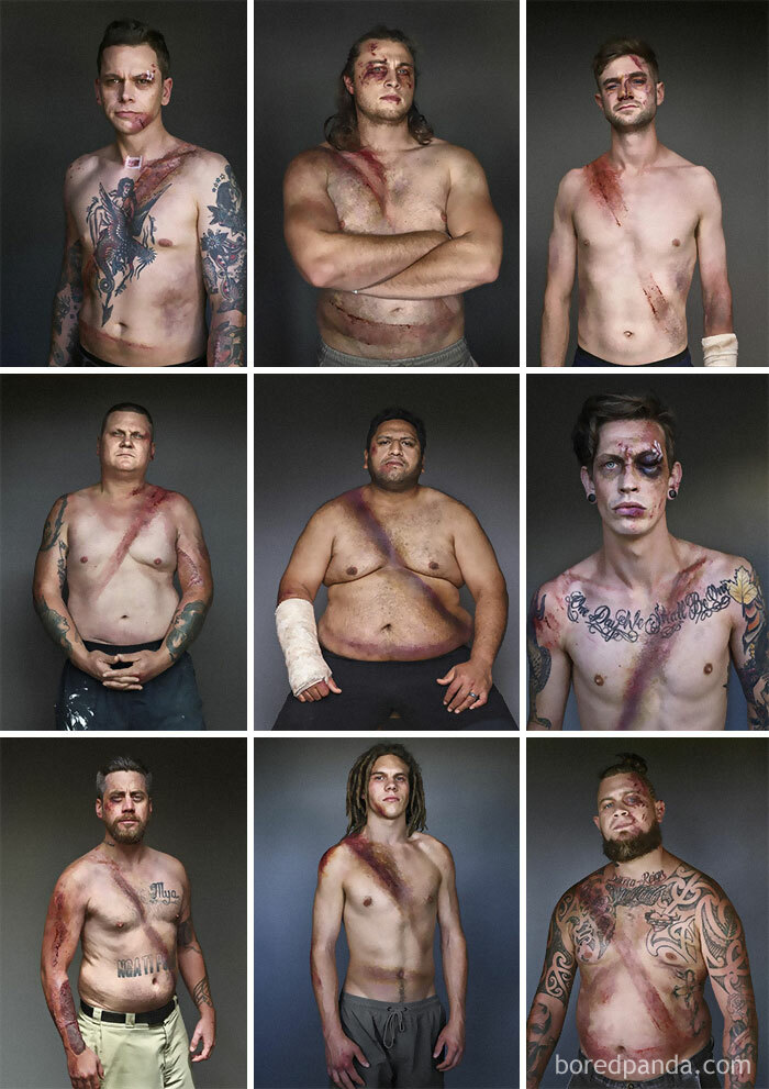 Car Crash Survivors Show The Lifesaving Effects Of Seatbelts