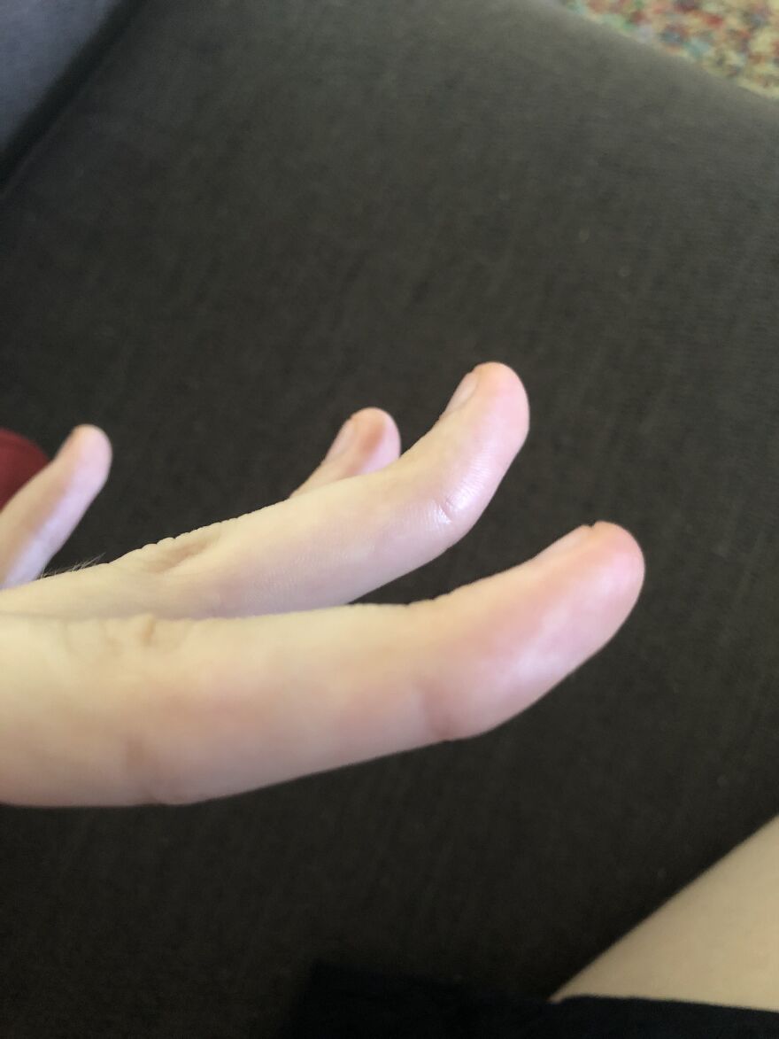 I Have Really Bendy Fingers! It’s Not That Impressive But Ah Well (Sorry For The Bad Photo)