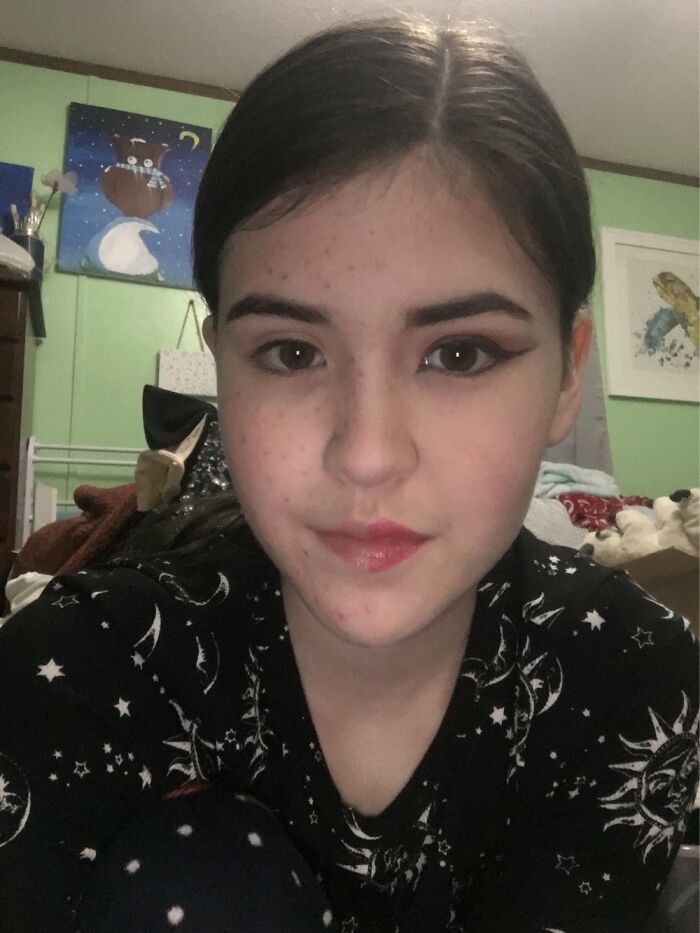 Never Noticed How Obvious My Freckles Were