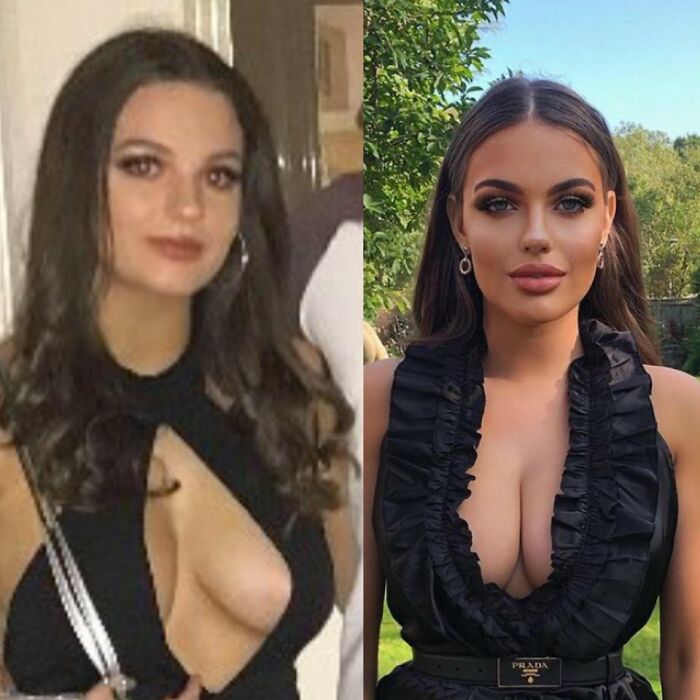 Why Does Everyone On Ig Want To Look Like This?