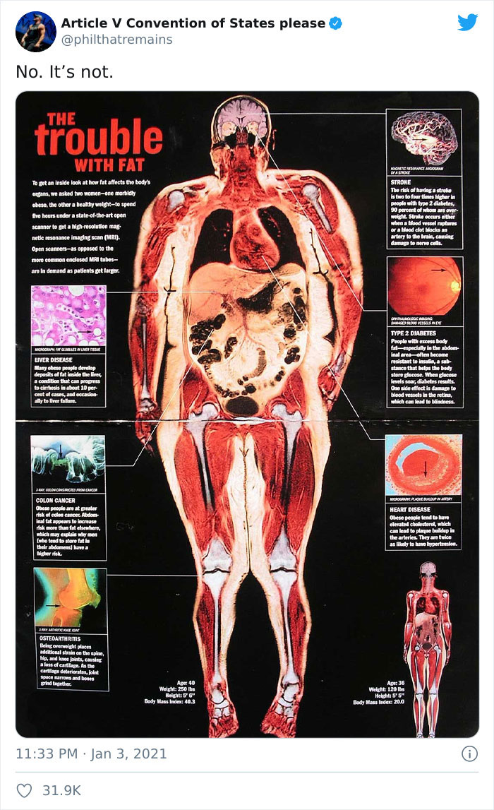 People Are Not OK With These Cosmopolitan Covers That Ignore The Relationship Between Obesity And Covid People Are Not OK With These Cosmopolitan Covers That Ignore The Relationship Between Obesity And Covid