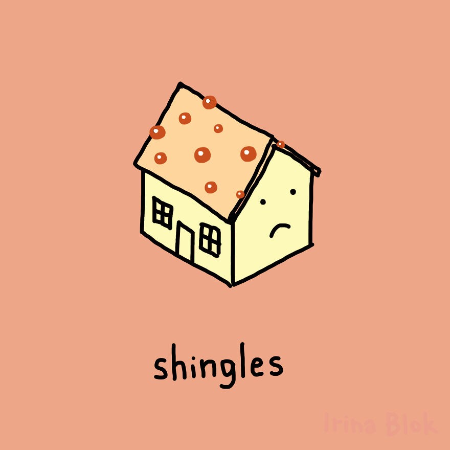 Shingles