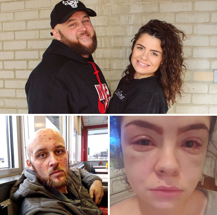 My Fiancée And I Made It Through A Long Distance Relationship Across The World From Each Other While Both Maintaining Our Own Individual Recovery From Addiction