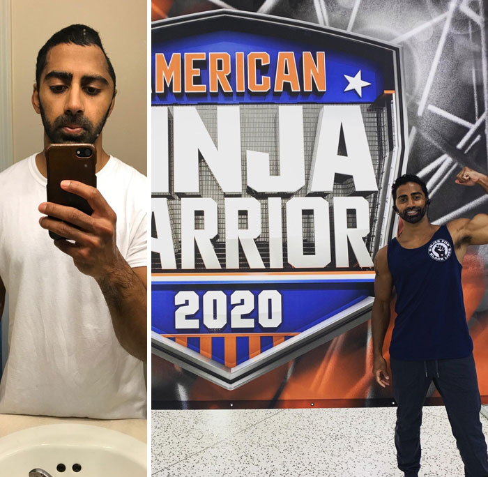 I’ve Gone From A Craniotomy To Ninja Warrior In The Span Of A Year