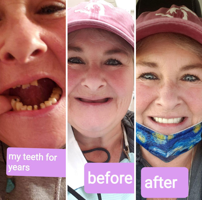 Was Gifted The Gift Of Smile And Mental Health Through Donated Dental Services Of Michigan