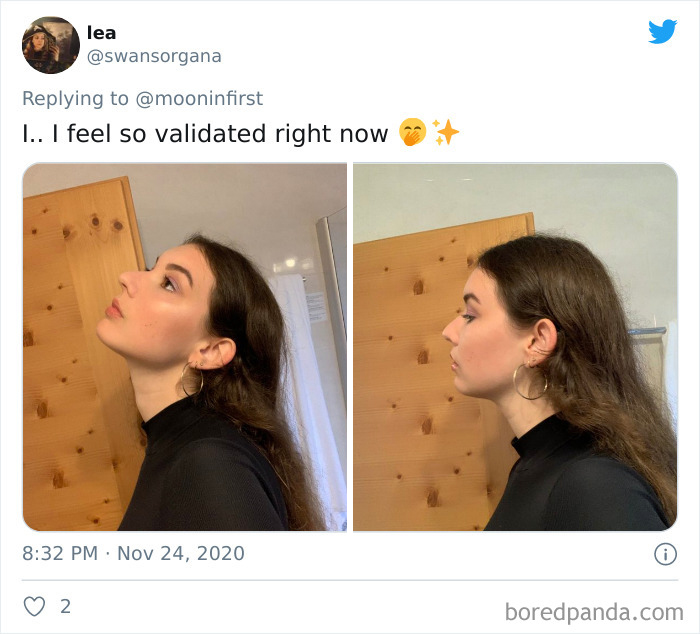 Women-Noses-Look-Like-Before-Photos