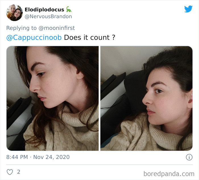 Women-Noses-Look-Like-Before-Photos