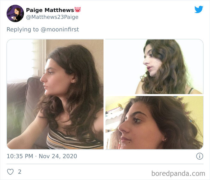 Women-Noses-Look-Like-Before-Photos