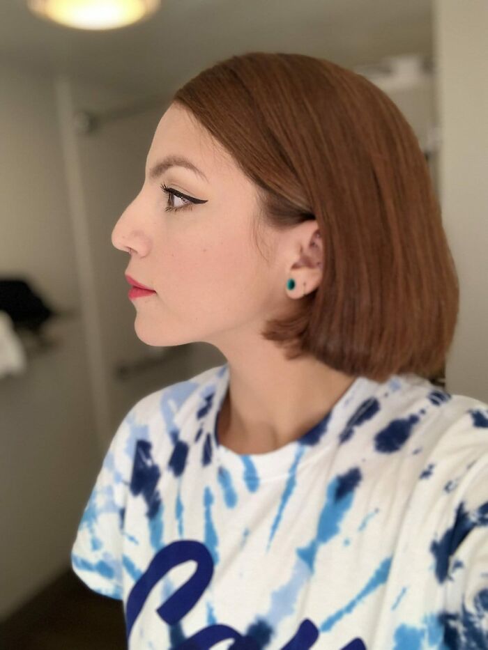 Women-Noses-Look-Like-Before-Photos