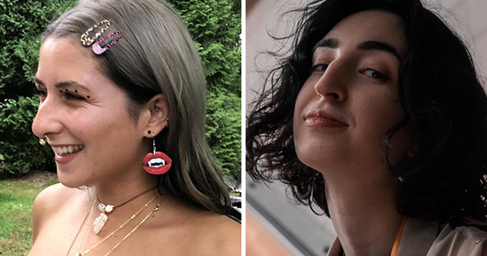 Women Are Posting Their Noses That Look Like “Before” Photos (30 New Pics)