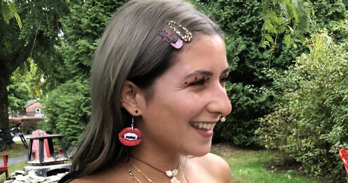 Women Are Posting Their Noses That Look Like “Before” Photos (30 New Pics)