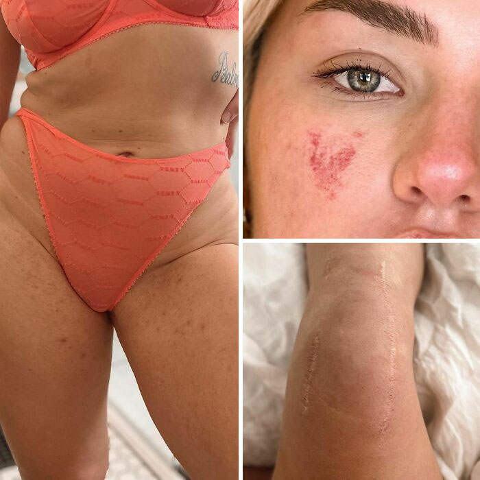 Body-Positivity-Normalize-Normal-Bodies