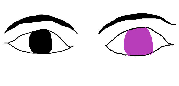Different Colored Eyes