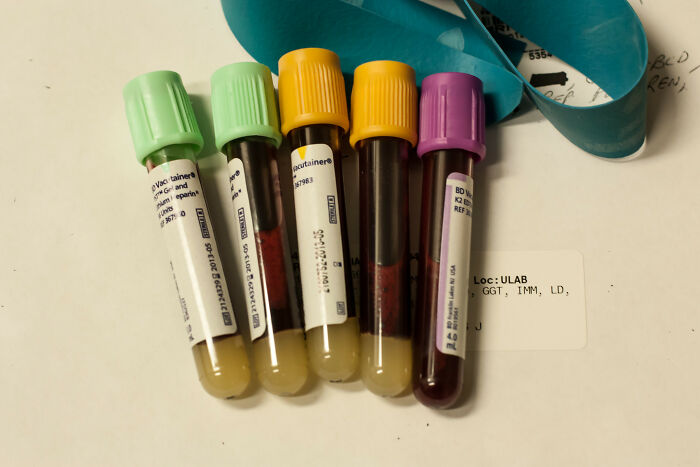 Test tubes with different colored caps containing blood samples for laboratory analysis in a clinical setting today I learned facts.