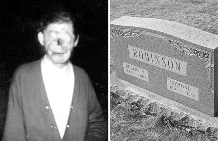 Black and white photos showing a man with a unique facial feature and a gravestone with the name Robinson, interesting facts people didn’t learn.