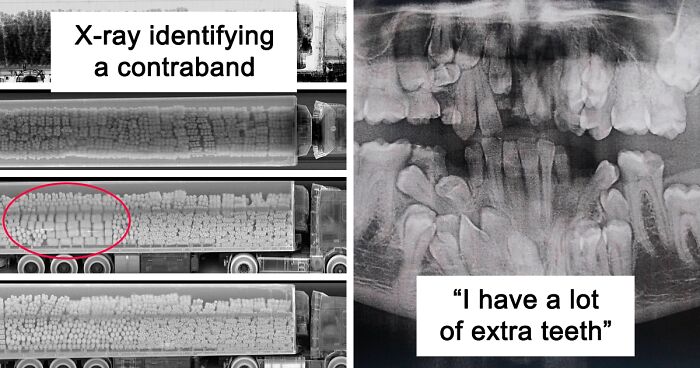 50 Times People X-Rayed Things And Got Interesting Results