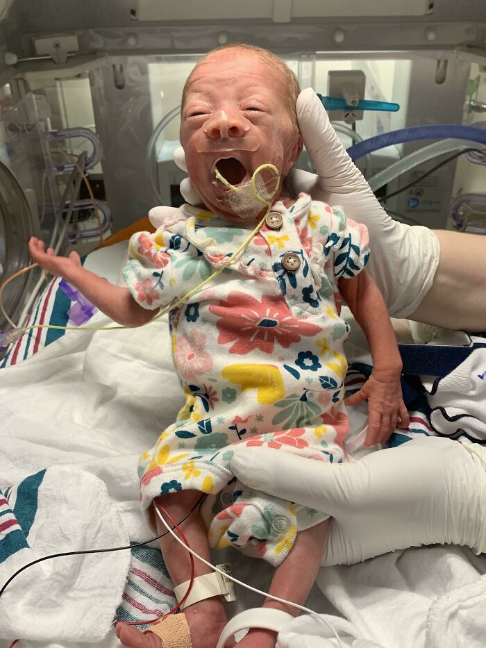 She Looks Like A Yawning Old Man