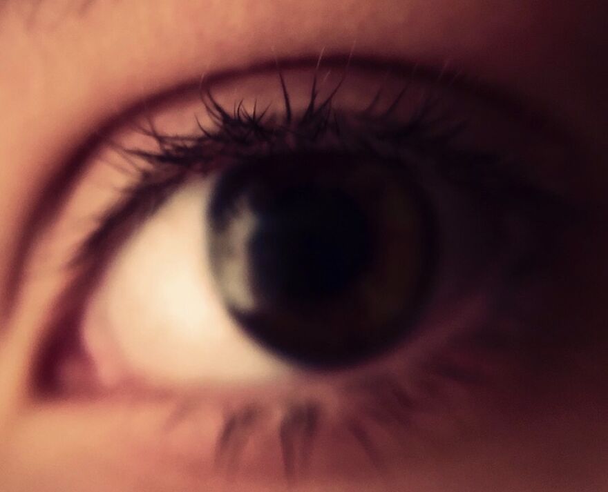 Eye