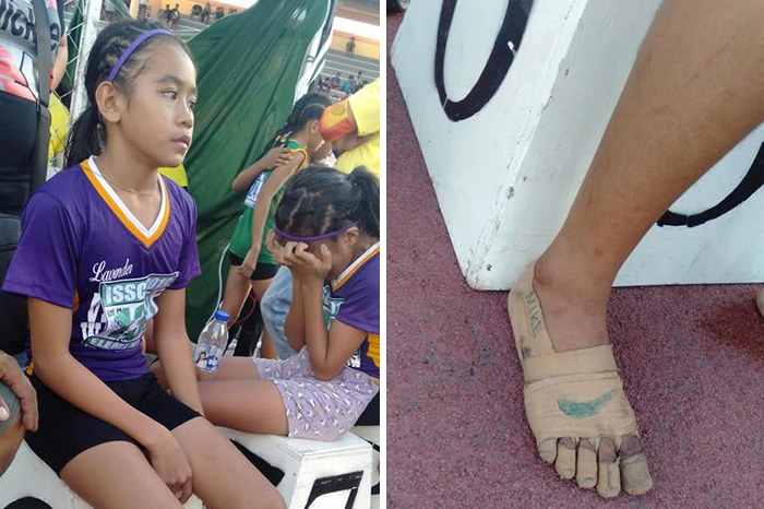 Two young girls in sportswear at an event and a close-up of a foot wrapped with tape, illustrating unusual facts learned today.