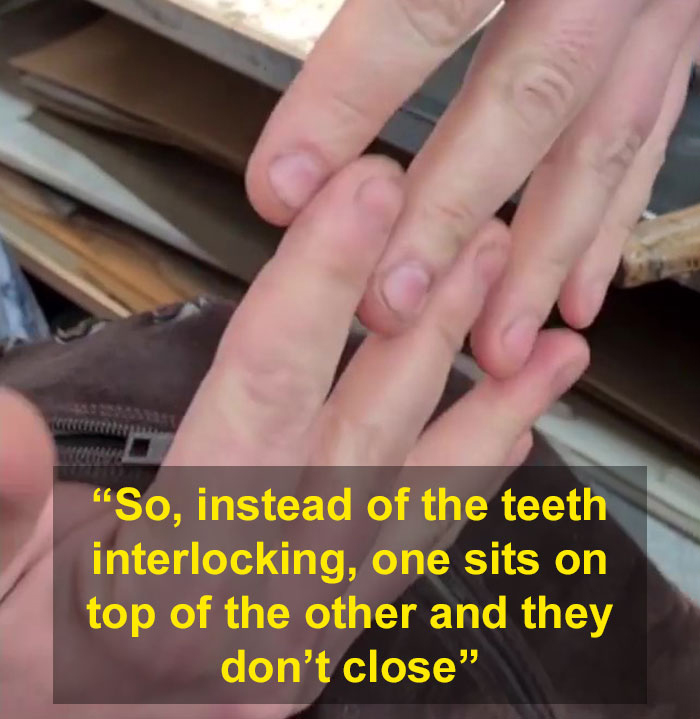 Man Considered A Zipper &lsquo;Wizard&rsquo; For Sharing An Easy Fix For Broken Zippers