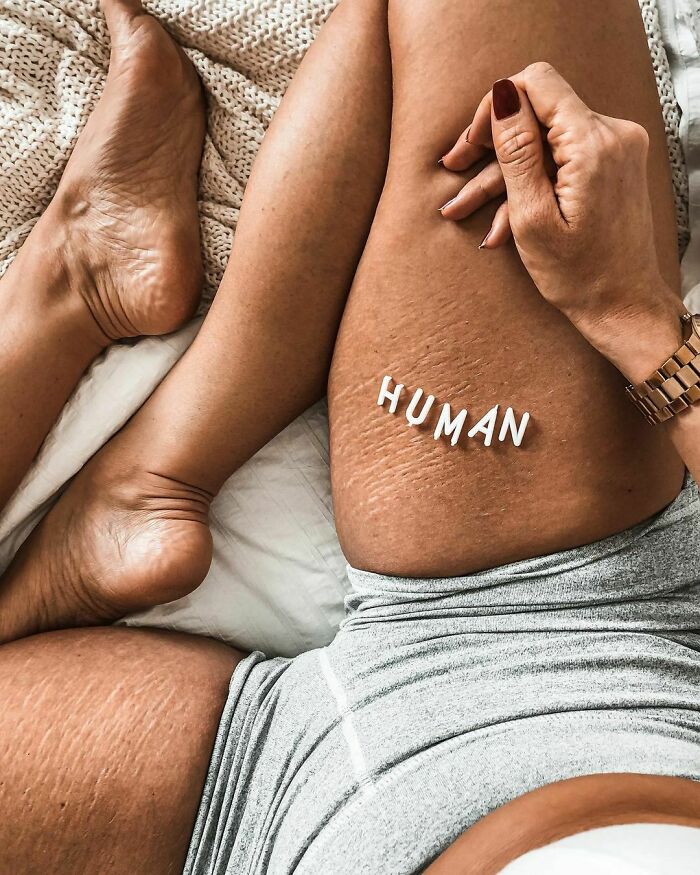 Body-Positivity-Normalize-Normal-Bodies