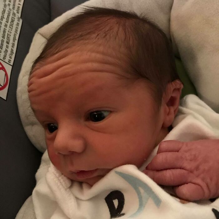 That Wrinkly Old Man Forehead