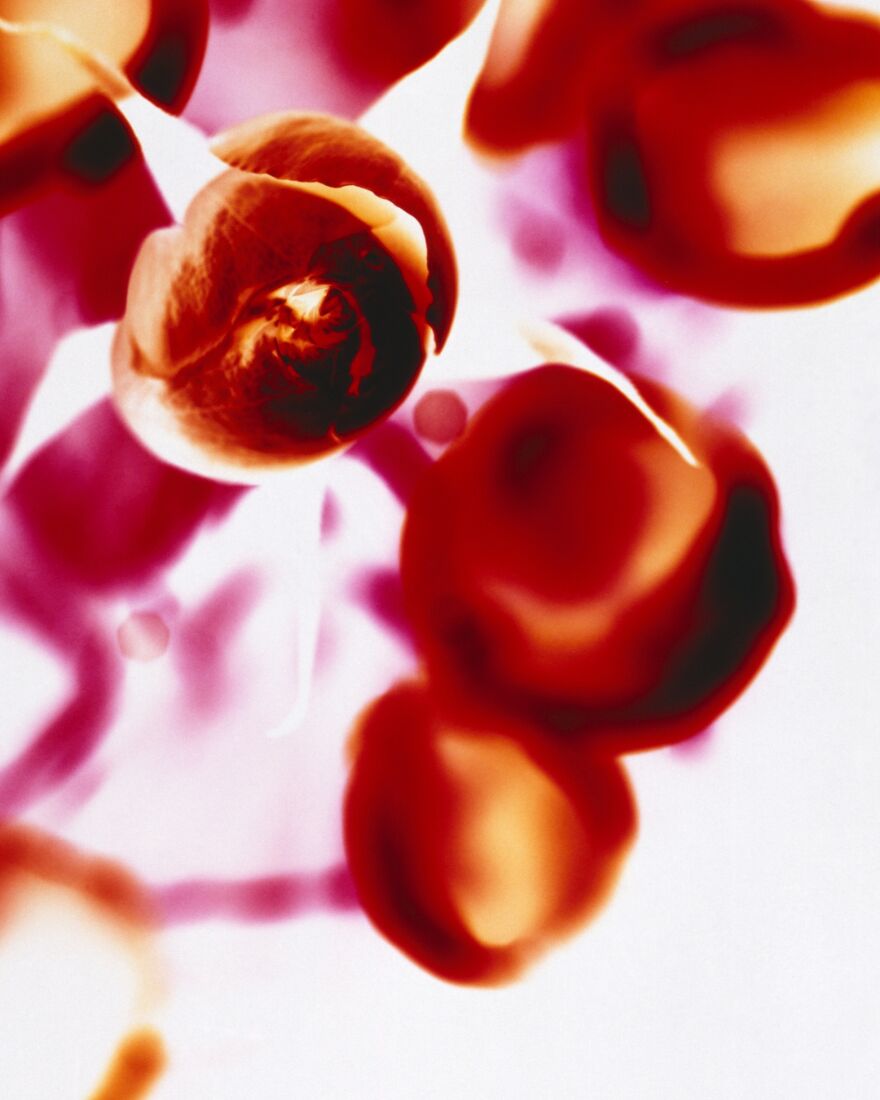 The Age Of Plasticizer (2nd Place / Analog / Film / Other)