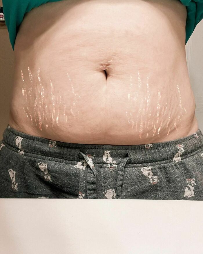 Body-Positivity-Normalize-Normal-Bodies