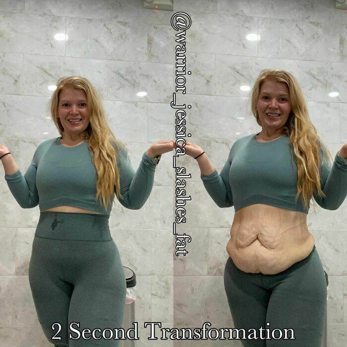 Body-Positivity-Normalize-Normal-Bodies