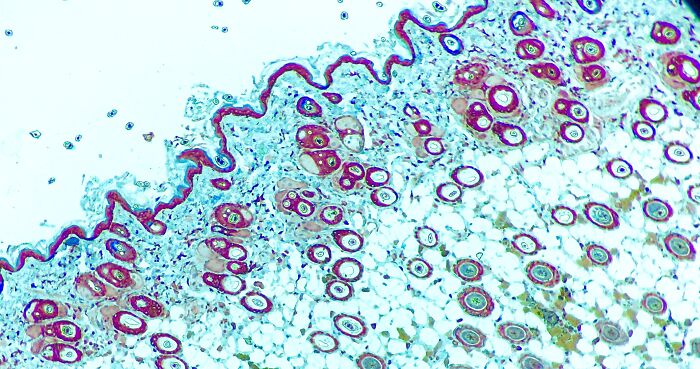 Immunohistochemical Stain Of Mouse Skin