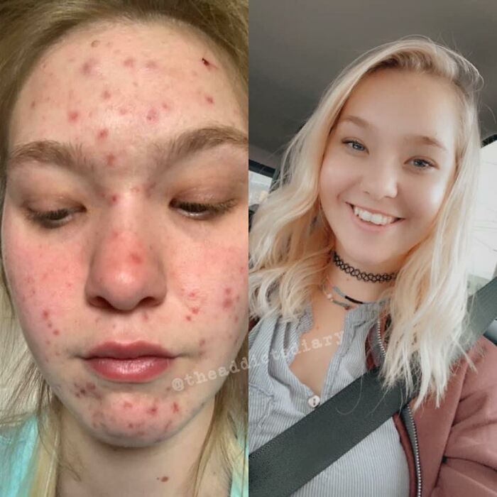 Before-After-Transformation-Stories-The-Addicts-Diary