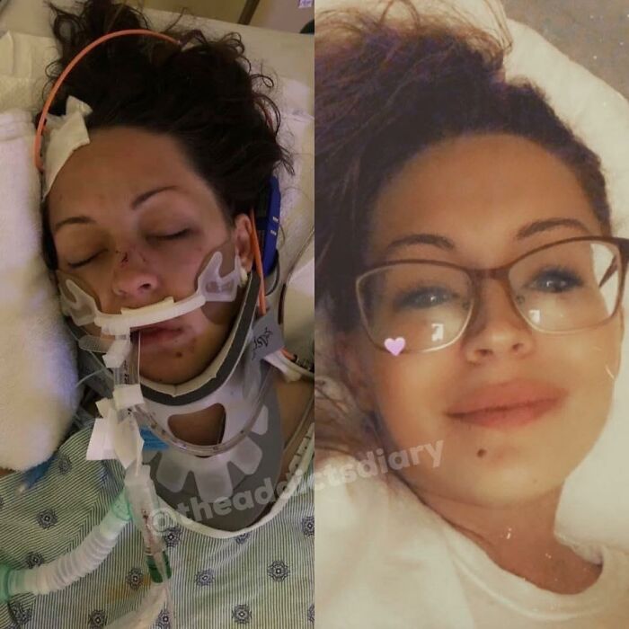 Before-After-Transformation-Stories-The-Addicts-Diary