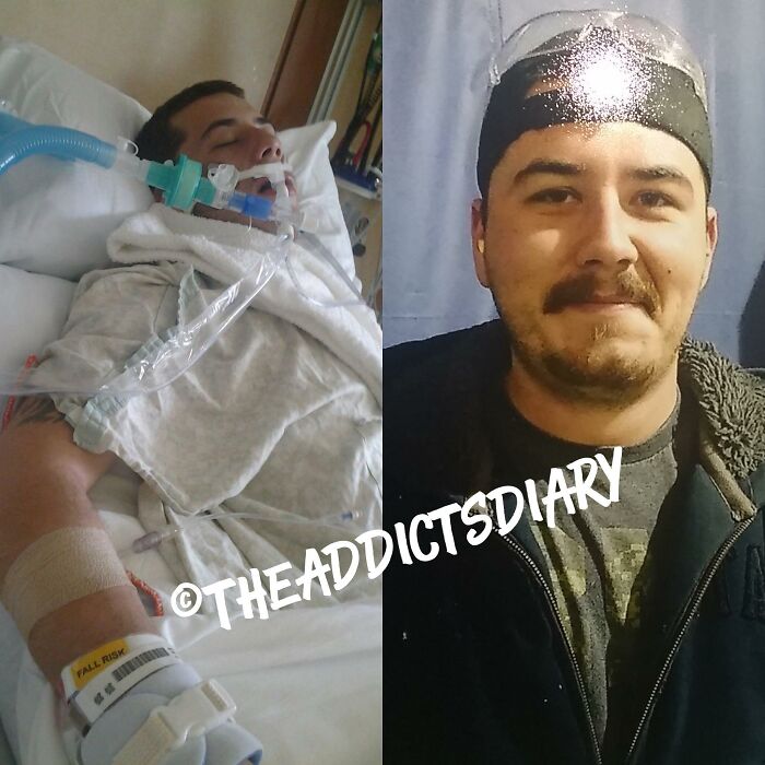 Before-After-Transformation-Stories-The-Addicts-Diary