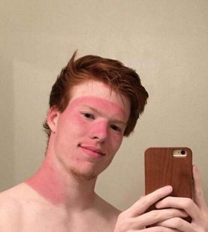 Perks Of Having Red Hair: Free Cancer