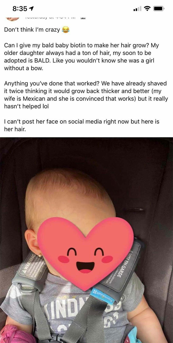 God Forbid, A Bald Baby!