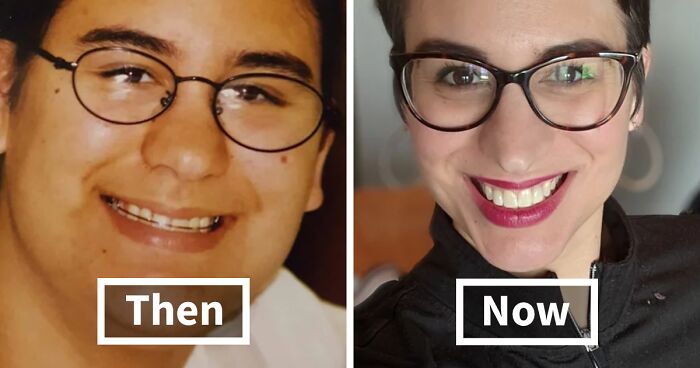 30 “Ugly Ducklings” Share Their Incredible Transformations Into Beautiful Swans (New Pics)