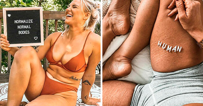 41 Women Post Unedited Pics To “Normalize Normal Bodies”