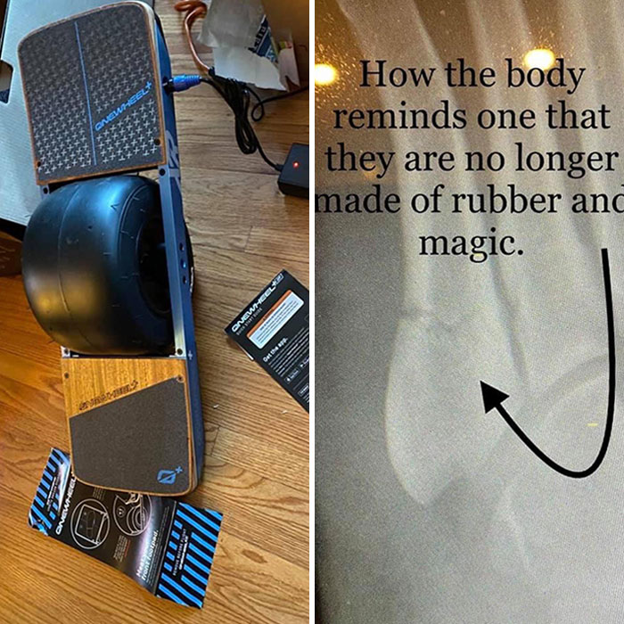 48-Year-Old Hubby Was So Excited To Get His One Wheel Yesterday. 24 Hours Later, His Foot Is In A Cast