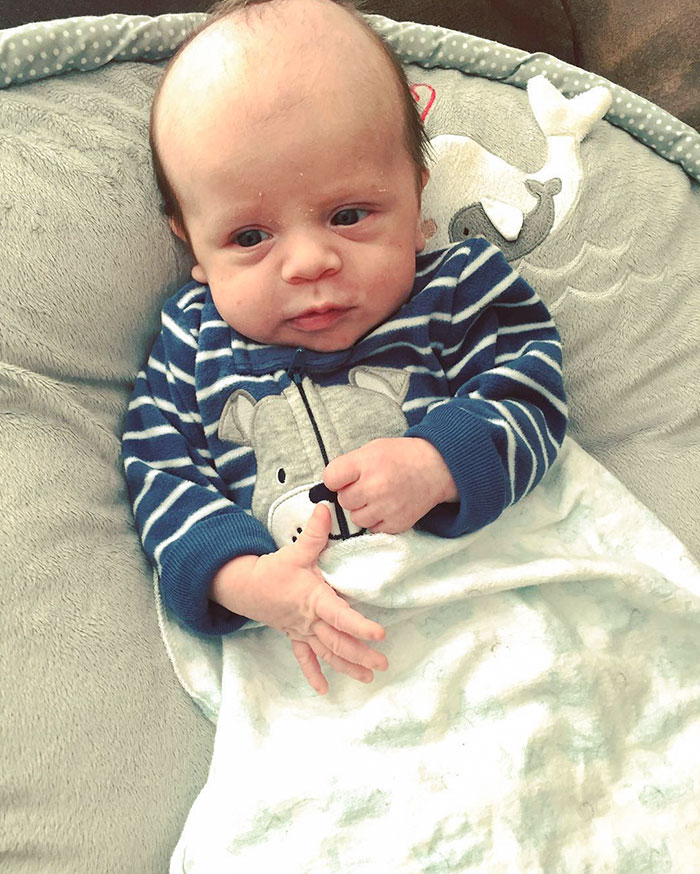 Looking Like A Little Old Man With That Hairline