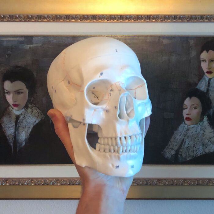 Medical Skull, $4.50 At Goodwill!