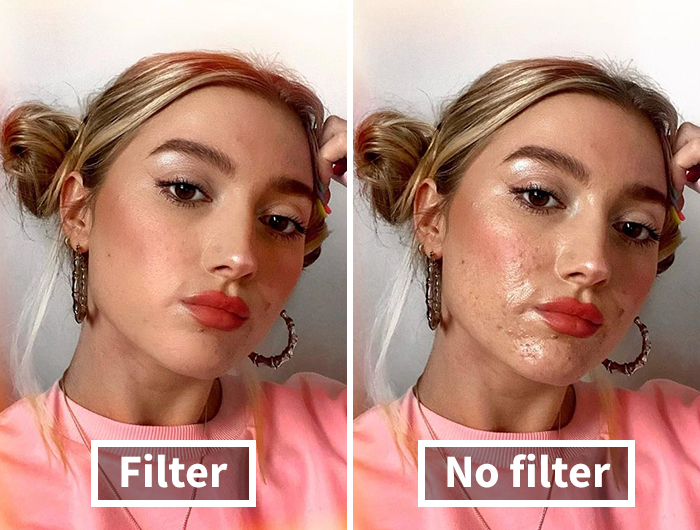 Women Join The #FilterDrop Challenge On Instagram, Share 22 Unfiltered Faces To Fight Against Retouched Paid Beauty Ads