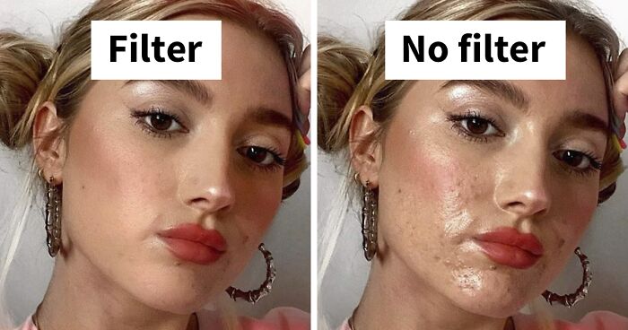 Women Join The #FilterDrop Challenge On Instagram, Share 22 Unfiltered Faces To Fight Against Retouched Paid Beauty Ads