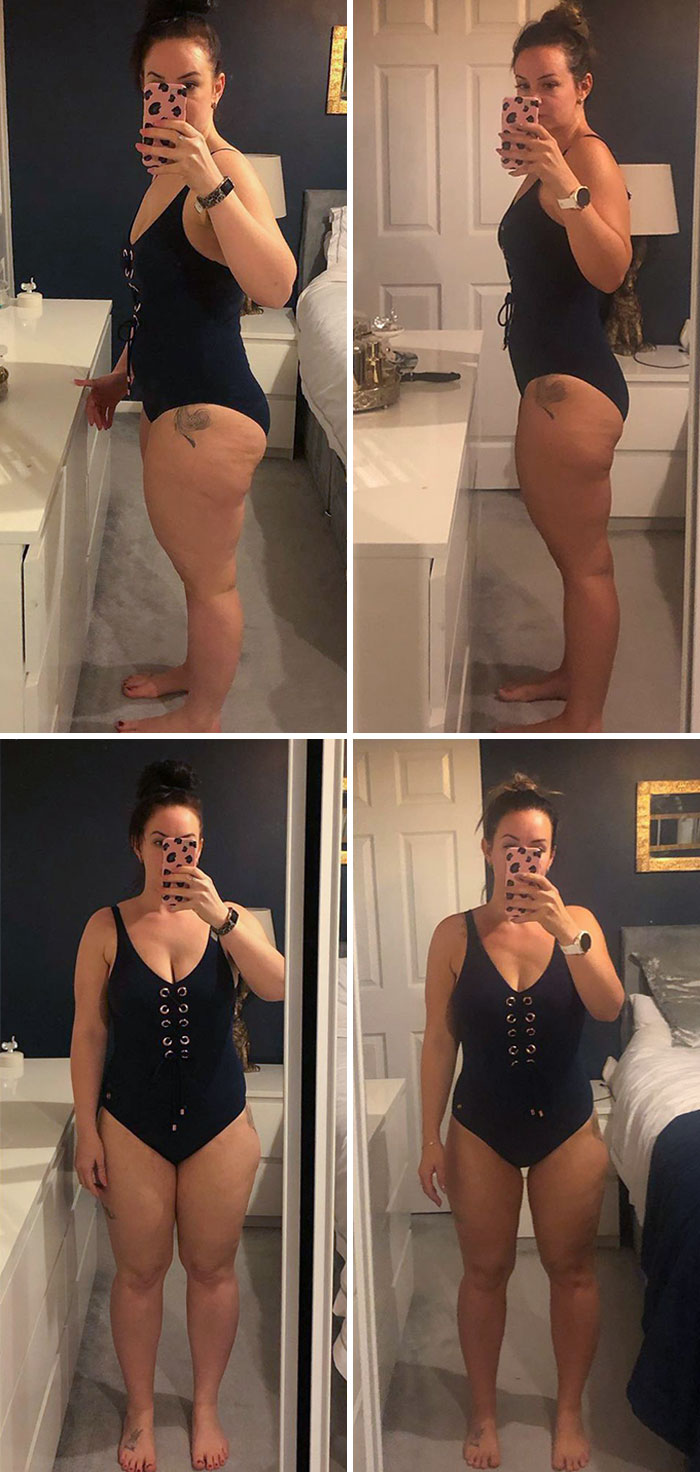 I’m The Same Weight In Both Before And After Pictures