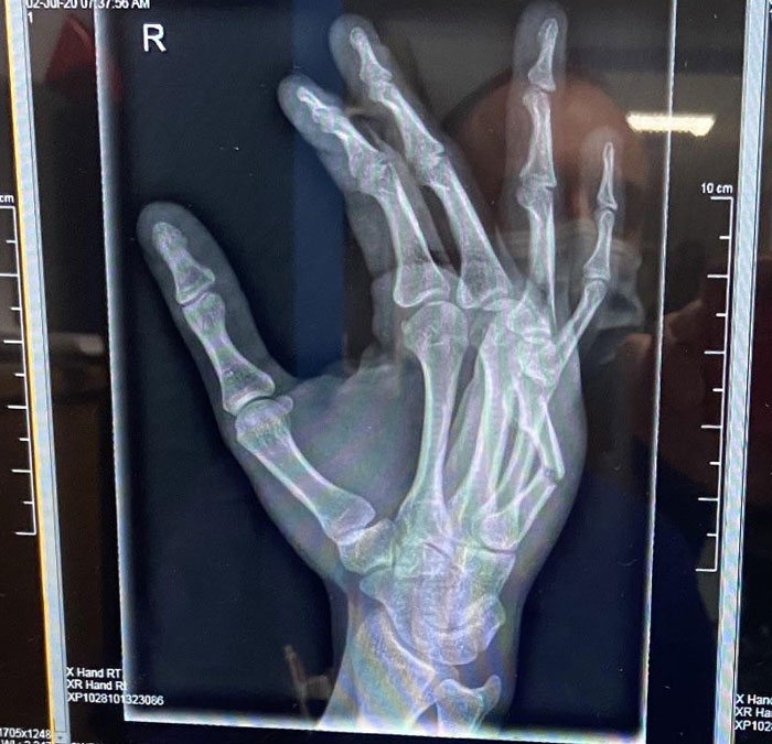 Don't Punch Things Folks