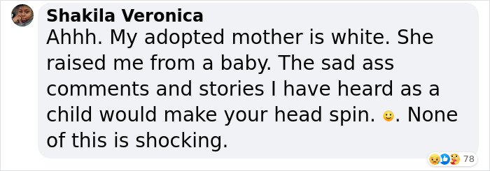 Biracial People Who Pass For White People Share Moments When Blatant Racism Took Place In Front Of Their Very Eyes