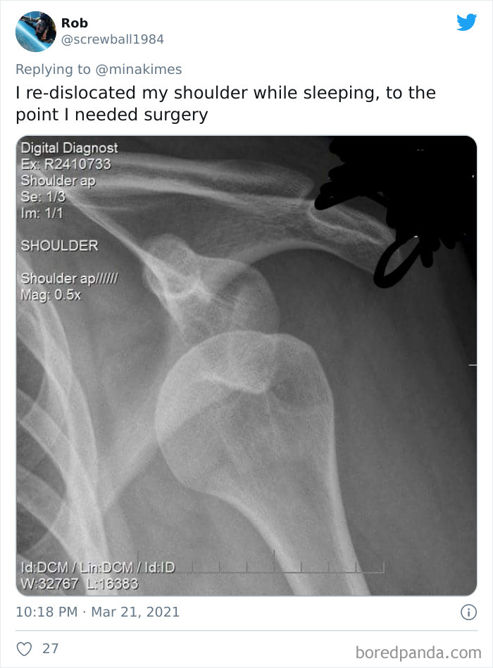 People-Share-Stupidest-Injury